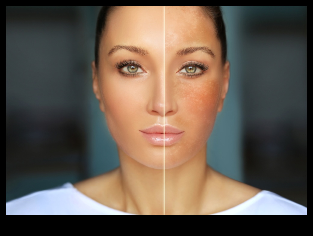 Cum poluarea mediului îți distruge pielea (și ce poți face în privința ei) 2 Impactul poluării mediului asupra pielii tale: protejează-ți tenul